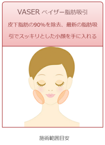 ベイザー脂肪吸引 上半身 女医の女性器形成 みどり美容クリニック 東京渋谷区広尾